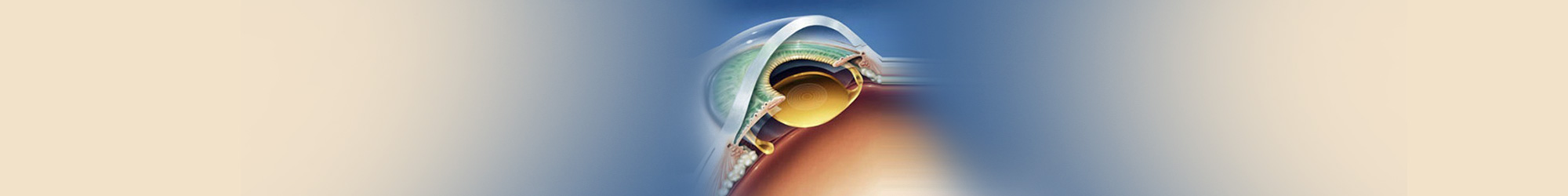 Lens Implant Treatment in Mumbai, Bandra, and Kandivali.